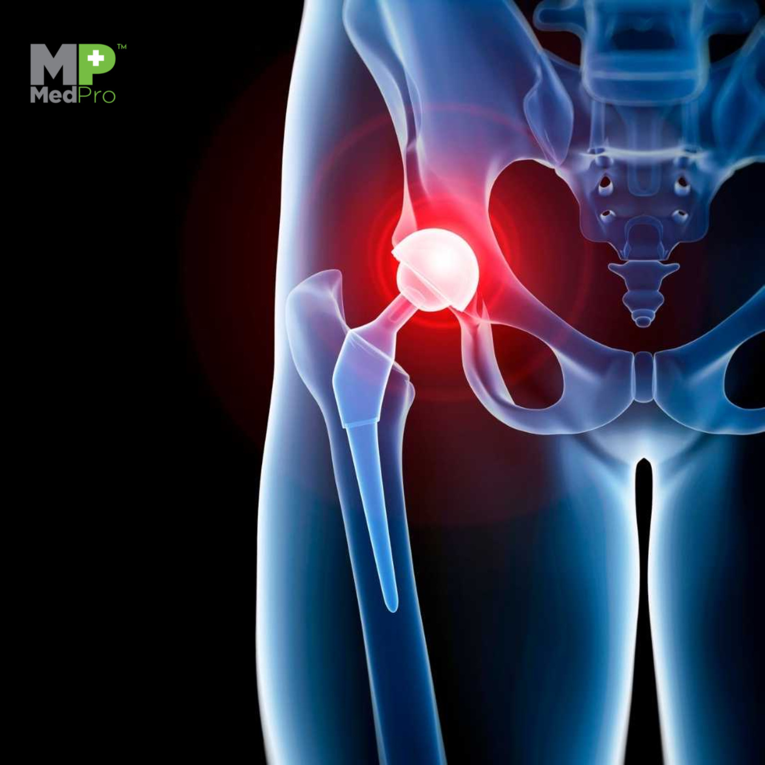 Hip Replacement Drape