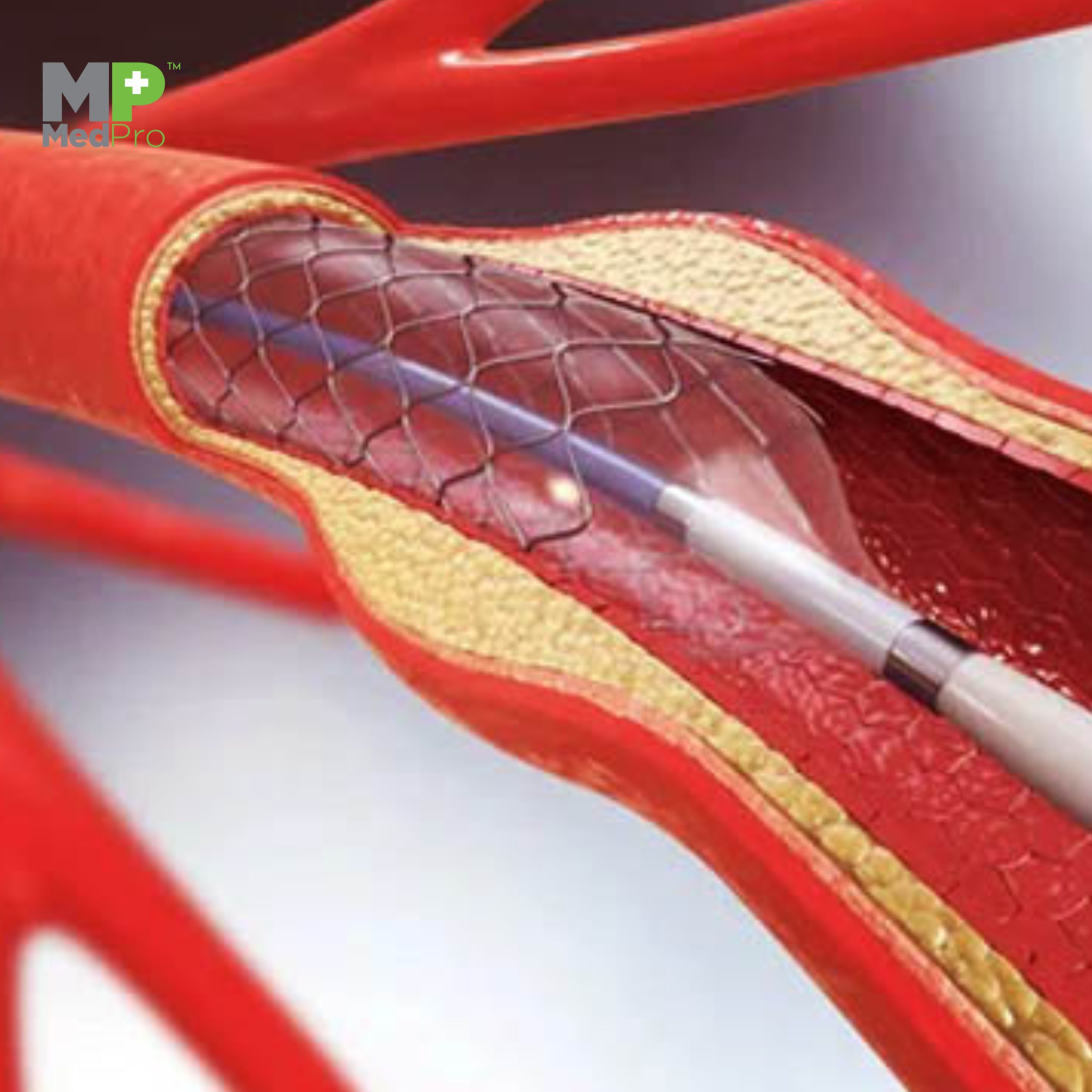 Angiography & Angioplasty Drape
