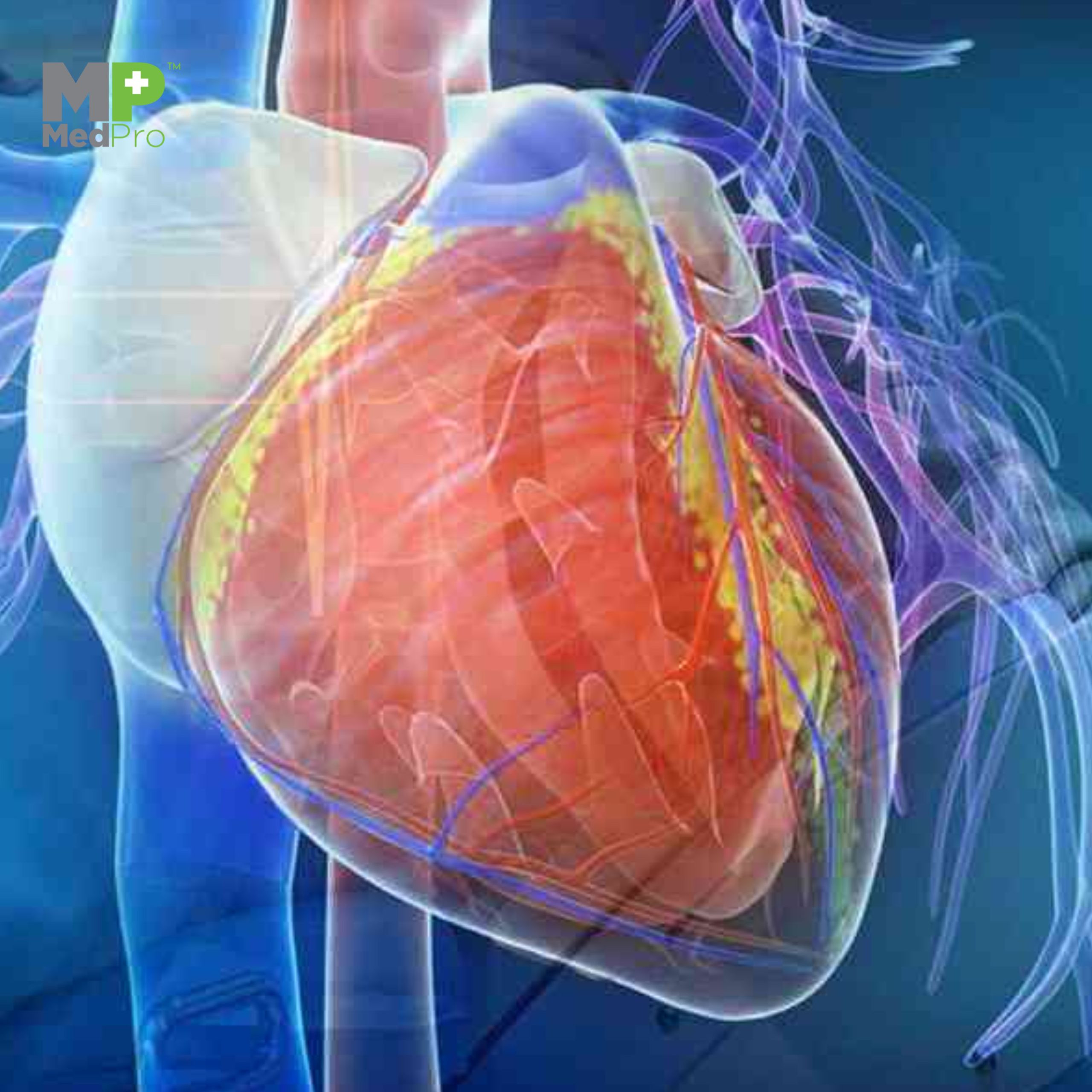 Cardiovascular Drape