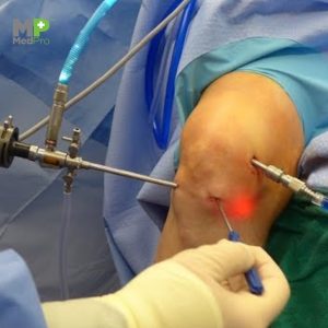 Arthroscopy Drape